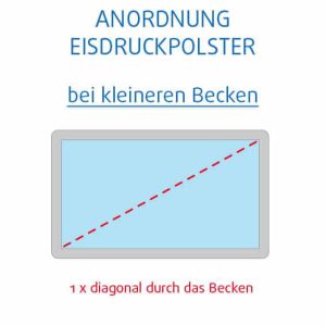 Diagonale Anordnung von Eisdruckpolstern